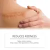Bálsamo hidratante para el cuidado de cicatrices en la piel transfronterizo, hidrata la piel del rostro y el cuerpo, alisa las cicatrices y rejuvenece la piel, crema de cuidado diario