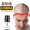 Líquido para Crescimento da Linha Capilar, Líquido Nutritivo para Cabelos, Líquido Espessante Anti-Queda de Cabelo, Óleo Essencial para Cuidados com os Cabelos, Essência para o Couro Cabeludo, Agente para Crescimento Capilar