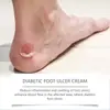 Creme para os Pés Houkea Creme Hidratante e Nutritivo para Cuidados com os Pés para Massagem Confortável e Hidratação das Solas dos Pés