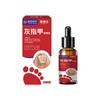 Medicina chinesa medicina onicomicose especial líquido superfície da unha espessamento brilhante unha cinza unha líquida macia solução de cuidados com as unhas geração cabelo