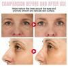 Eelhoe Retinol Crema para Ojos en Barra Fórmula Suave Hidratante y Humectante Piel de Ojos Nutritiva Delicada Crema Facial para Ojos