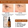 Esencia Facial de Retinol Eelhoe Suave Hidratante Reponedor de Humedad Poros y Unificante Esencia Facial