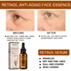 Esencia Facial de Retinol Eelhoe Hidratante Suave Rellena la Humedad Reduce Poros y Alisa Esencia Facial