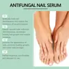 Esencia para el Cuidado de las Uñas Luna del Sur Crema Suave para Uñas Limpieza Iluminadora para Uñas Cuidado de Uñas Gruesas para Pies Uña