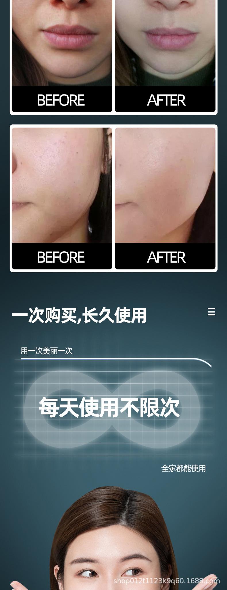魔法活氧泡泡机美容仪