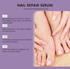 Solução para Cuidado de Unhas XIMONTH Limpeza Suave de Mãos, Pés e Unhas Solução para Cuidado de Unhas Macias e Suaves
