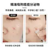 Adesivo para espinhas ACNE tipo hidrocolóide óleo essencial estrela rosto desenho animado adesivo para espinhas 20 peças cobertura física adesivo para cicatriz de acne