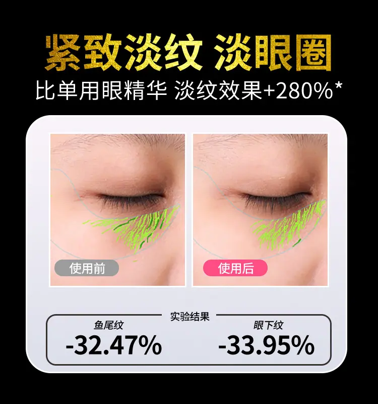 S2309R-眼部射频仪详情页_06.jpg