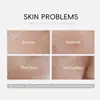 Produto Novo Transfronteiriço Laiko Sakura Essência Ampola 2ml*10 Essência Hidratante Facial Atacado Niacinamida