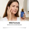 Esencia Facial Hidratante y Nutritiva para la Piel del Rostro, Textura Ligera, Hidratante y Refrescante, Esencia de Cuidado Diario para la Piel