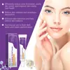 Crema Reparadora con Ácido Azelaico Mes de Occidente Reparación Suave Crema Purificante Facial para la Piel
