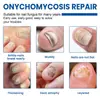 Patch Ximonth para Cuidado das Unhas, Unhas Macias e Bem Cuidadas para Mãos e Pés, Confortável, Fresco, Respirável e Adequado para Cuidado