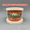 Modelo ortodôntico dental modelo autoligante de cermet oral display de comunicação médico-paciente ambulatorial modelo dental de ensino