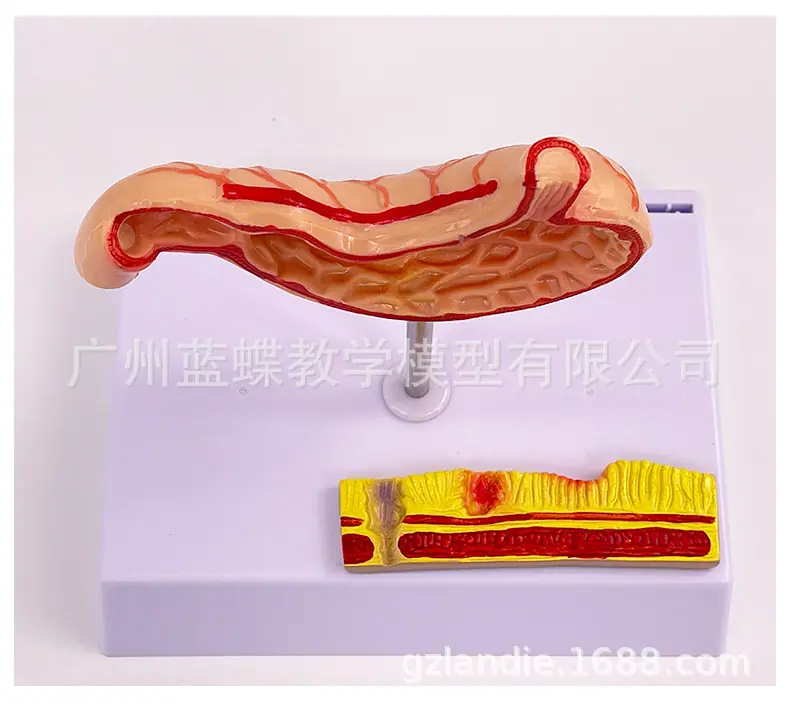 详情_20