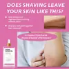 Óleo Pós-Barba Masculino Transfronteiriço Suaviza a Pele, Hidrata e Nutre os Pelos, Óleo Essencial para Cuidados Pós-Barba Óleo Pós-Barba