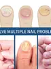 Hanel comercio exterior transfronterizo al por mayor crema antibacteriana reparadora para onicomicosis crema reparadora para bacterias ungüento para el cuidado de las uñas