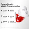Máscara Facial de LED Vermelho 510k Máscara Facial Fotônica de Luz Vermelha e Azul Dispositivo de Beleza Facial de Silicone Líquido