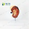 Modelo Anatómico de Riñón Humano 1.5 Veces Estructura del Riñón Modelo de Glándula Suprarrenal Modelo Médico de Urología