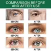 Gotas Oftálmicas Ximonth Transfronterizas para Fatiga Ocular, Sequedad, Picazón, Dolor, Hinchazón y Visión Borrosa, Producto Popular, Disponible para Dropshipping