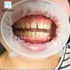 Abrebotellas Yijiijia Silicona 3D Estéreo Goma Barrera Forma de O Soporte Bucal Almohadilla Dental para Morder para Niños/Adultos