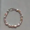Set de Pulsera y Collar de Plata de Ley 925 de Alta Calidad con Perlas Naturales Roto