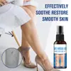 Spray Herbal Transfronterizo Más Vendido para Protección de Venas Que Cuida las Piernas, Relaja y Mejora la Circulación Sanguínea, y Repara las Venas