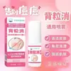 Spray Japonés Popular para Acné de Espalda 2026, Spray Limpiador Antibacteriano para Granos y Acné de Espalda, Producto de Influencer de Tiktok