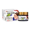 Creme para Acne 30g Creme Herbal Externo para Espinhas Pequenas nas Costas, Creme Universal, Fornecimento Direto da Fábrica Personalizado, Pode Ser Enviado em Nome de Terceiros