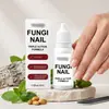 Gotas para el cuidado de las uñas: un producto de cuidado diario suave, hidratante y refrescante que limpia, hidrata y calma la piel alrededor de las uñas