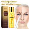 Esencia Cuidado de la Piel con Polipéptidos de Ginseng Hoygi Cuida las Líneas de Expresión, Mejora la Opacidad, Hidrata y Elasticiza la Piel