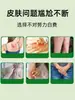 Medicina Herbal de Yunnan Bálsamo Yunnan Baicao Alivio de la Picazón Crema Herbal para Molestias en la Piel y Picaduras de Mosquitos Crema de Uso Externo para Reenvío