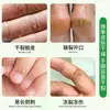 Adesivos para Rachaduras Secas para Mãos, Pés e Calcanhares, Essenciais no Inverno, Portáteis, Respiráveis, Adesivos para Adultos, Anti-Atrito, Adesivos para Rachaduras Secas com Aloe Vera