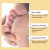 Spray para el Cuidado de los Pies con Veneno de Abeja Ximonth Suave e Hidratante Cuidado para el Confort de los Pies Cuidado Hidratante Diario de la Piel