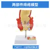 Modelo de Simulação de Ensino de Patologia do Intestino Grosso Humano, Lesões de Hemorroidas Gastrointestinais Retais, Anatomia de Doenças Intestinais, Lesões Colônicas