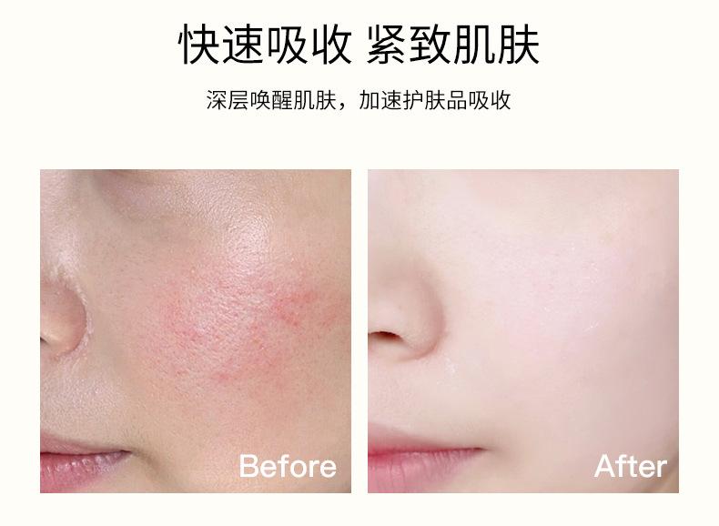 导入美容仪_08.jpg