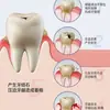Haishi Hainuo Revelador de Color de Placa Dental Hisopos de Algodón Desechables para Niños y Adultos, Empacados Individualmente