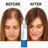 Essência para Cabelo Transfronteiriça Sérum Roll-On para Crescimento Capilar Essência Hidratante e Nutritiva para Cuidados com o Cabelo