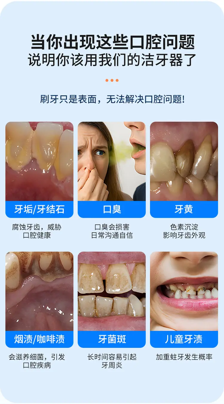 洁牙器-拷贝_03