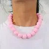 Amazon Moda Collar para Niños y Mujeres 10 Bolas Acrílicas de Color Rosa Mixto Cadena para Suéter