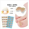 Pasta para uñas sin pegamento surco de uña dispositivo de corrección de uñas uña del pie parche para uñas tienda de fábrica de manicura Lala