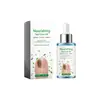 Aceite Hidratante para Uñas Nutrición Suave para Uñas y Lechos Ungueales Suavizante e Hidratante Cutícula Iluminadora Esencia para Uñas
