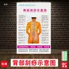 Diagrama de Gua Sha de Espalda Centro de Salud Belleza Cuerpo Humano Punto de Acupuntura Mural Medicina Tradicional China Cartel Promocional Pegatina de Diagnóstico de Columna Vertebral