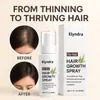 Spray Transfronterizo para el Crecimiento del Cabello Spray de Romero para el Cuidado del Cabello Aceite Esencial para el Cuidado del Cabello Aceite Esencial para el Cuidado del Cabello Liso