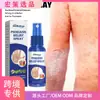 Spray Calmante para la Piel South Moon Transfronterizo 30ml Alivia la Picazón de la Piel, Mejora la Descamación, la Picazón Seca y el Enrojecimiento