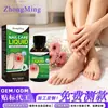 Zhongming Amazon Solución Transfronteriza para el Cuidado de las Uñas, Suavizante de Color de Uñas Solución Herbal para la Salud de la Onicomicosis Venta al por Mayor 1
