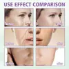 Crema Lifting Hoygi para Disminuir Líneas Finas Piel Delicada Suave Hidratante Humectante Disminuye Líneas Finas Suavizante Lifting Elasticidad