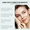 Crema Facial Wiyun Transfronteriza Hidratante, Humectante y Aclaradora de Manchas Faciales, Crema Hidratante, Suavizante y Iluminadora de la Piel