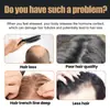Eelhoe Champú para el Cabello Cuidado Diario para Cabello Esponjoso Cuidado Suave Champú para el Cuidado del Cabello