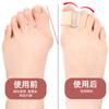 Separador de Dedos del Pie Pulgar Hallux Valgus Dedos Superpuestos Separador Suave Anti-Desgaste Separador de Dedos Ajustable con Velcro