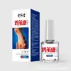 Ali Pharmacy Solución para el Cuidado de Ojos de Pollo para Callos en los Pies, Spray Antibacteriano para Pies, Tratamiento Exfoliante, Venta al por Mayor y Dropshipping